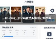 08.cms（08cm肾结石能自己排出吗）